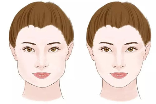 瘦脸卡通对比图 瘦脸卡通对比图