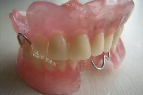 活动假牙图片一览