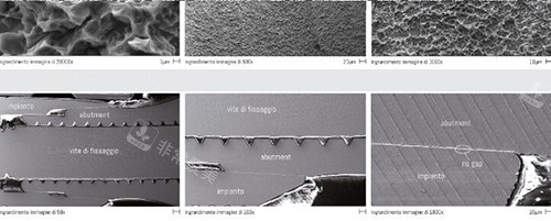 西泰克种植牙表面处理