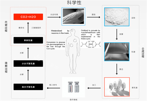 艾维岚Löviselle科学性