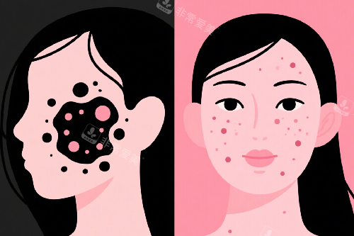 成都市第二人民医院皮...