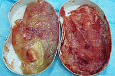 奥美定组织照片