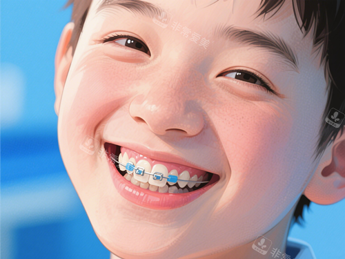 儿童金属托槽矫正