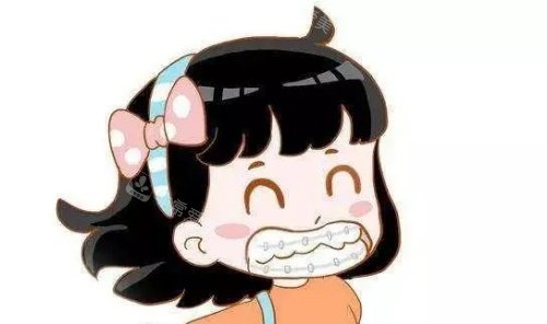 儿童金属矫正示意图