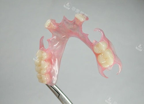 半口活动假牙展示