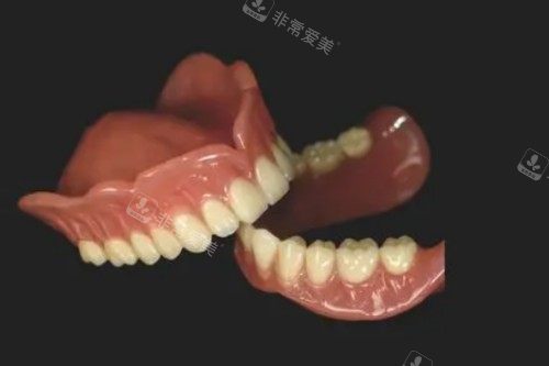 活动假牙图片展示