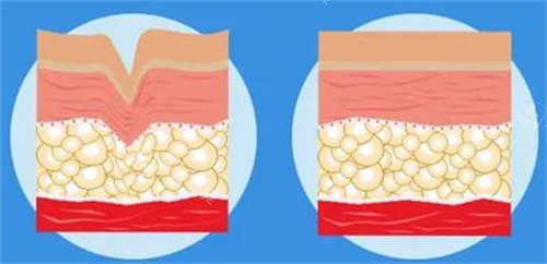 爱塑美童颜针注射前后对比图