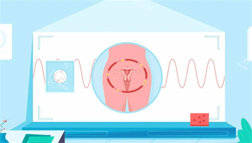 私密紧致卡通图