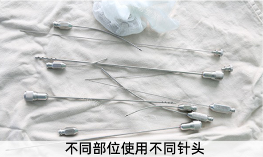 昆明吸脂手术哪家医院做的好？昆明韩辰、昆明艺星、昆明吴氏嘉美都是很出色的医院！