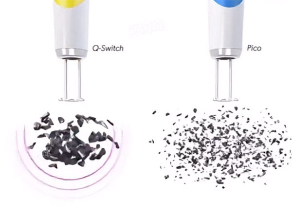 调Q激光和皮秒对比图