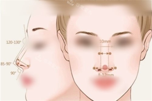 重庆吴松隆鼻怎么样？深耕鼻整形多年！鼻综合+鼻修复双专长，技术优势与术后反馈一站式看够！