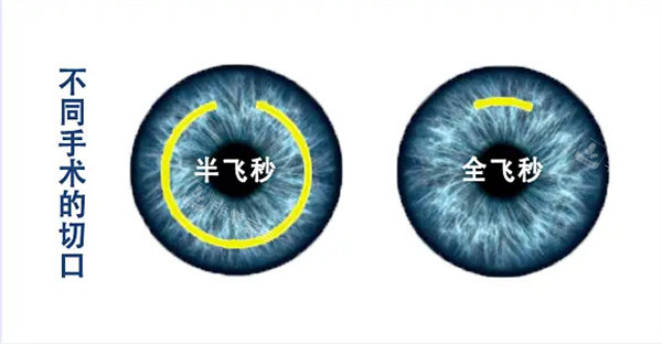 半飞秒和全飞秒区别