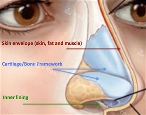深圳有名的鼻修复医生...