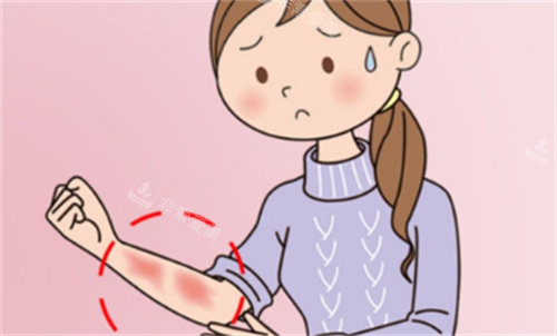 韩国医院做刀疤修复手术真实体验分享！十年旧疤终于平了，颜色也淡了好多！