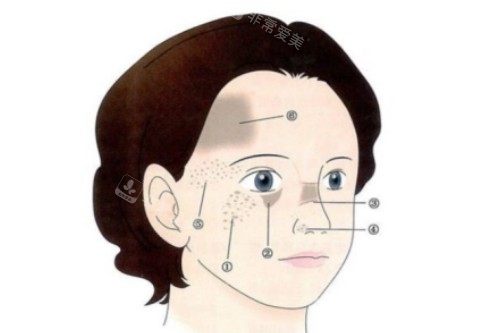 脸上有胎记卡通展示图