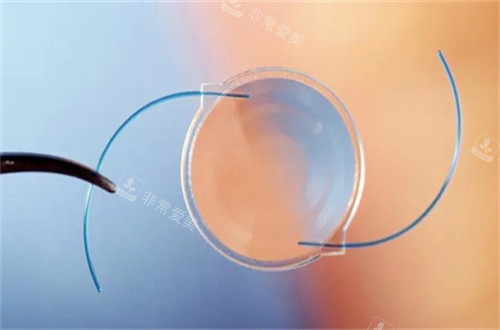 白内障人工晶体