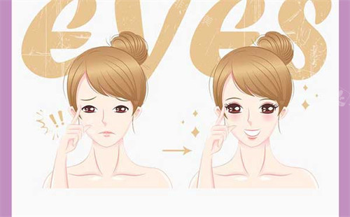 雙眼皮手術(shù)前后對(duì)比圖 雙眼皮手術(shù)前后對(duì)比圖