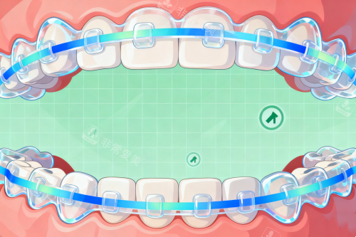 牙齿矫正卡通图片展示