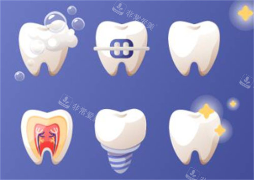 牙齿的各个项目