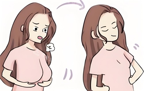 无锡李建东维维提升跟乳房悬吊一样吗?价格差3万+3大技术区别+真实患者反馈!