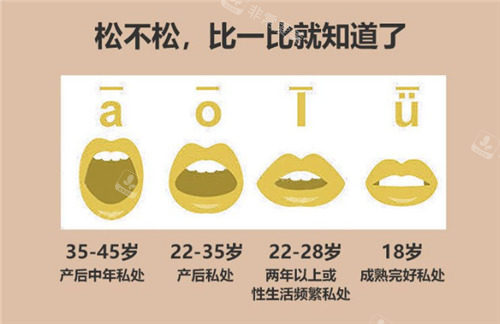 成都高新城南妇幼医院私密科怎么样?阴道紧缩和阴唇整形技术好,附简介地址和私密整形价格表！