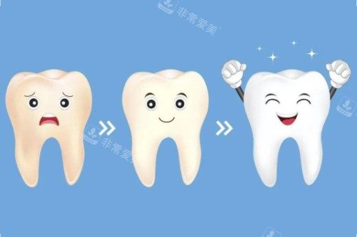 牙齿美白顺序图