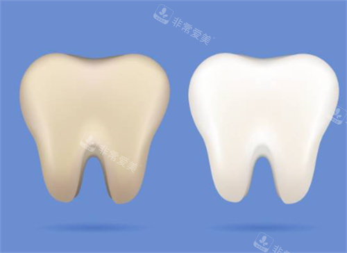 牙齿美白前后图