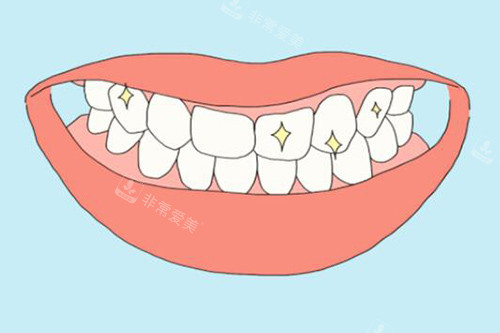 牙齿美白改善图展示