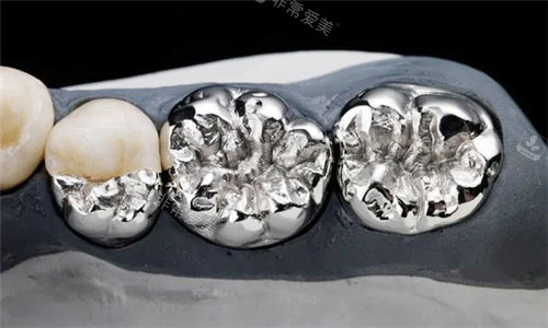 烤瓷牙素材图片