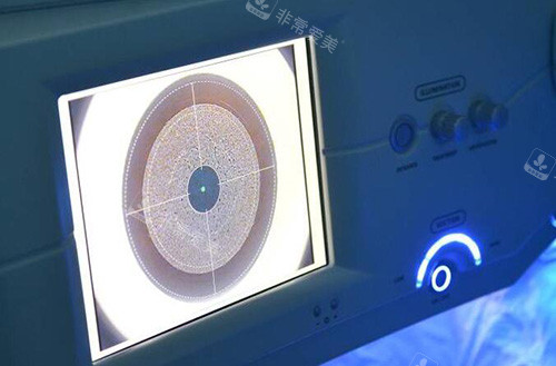 近视改善展示图