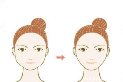 下颌角整形卡通前后对比图