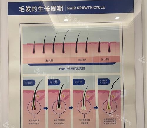 北京大麦微针植发医院毛发周期