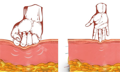 双逆博士作用皮肤组织动画展示图