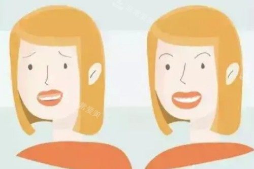 韩国做凸嘴矫正好吗？正规团队+新型设备，矫正效果好到超出预期！