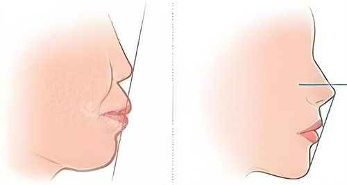凸嘴对比卡通图