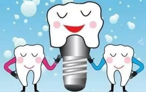 牙齿种植体示意图