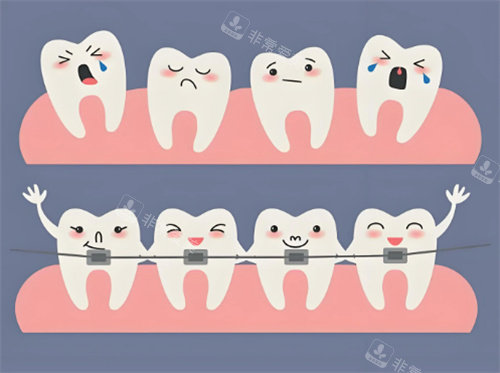 牙齿矫正卡通展示