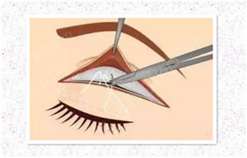 在韩国做医美是什么价格？本人整理的真实报价+避坑指南给你们！