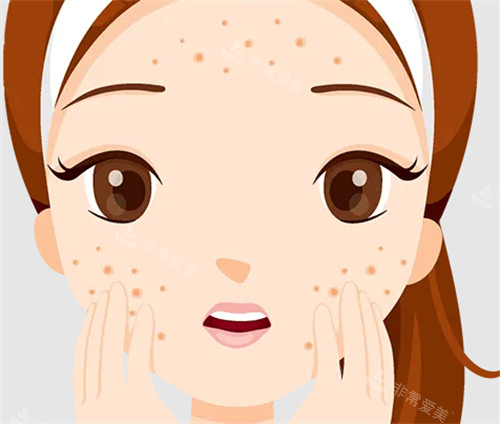 痘印治疗多少钱