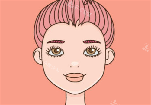 双眼皮手术经过