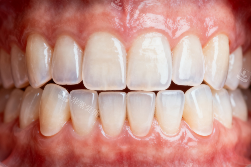 干净整洁牙齿卡通图