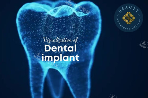 以色列dentin种植牙宣传图