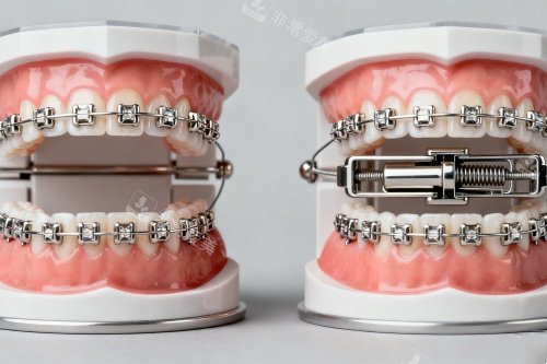 金属矫正器卡通图片