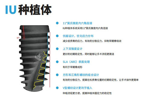 韩国沃兰种植牙怎么样