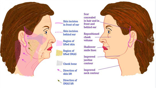 韩国圣水newlline皮肤科预约挂号靠谱吗？官方通道直连，简介口碑双保障！