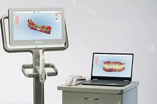 数字化牙齿矫正示意图