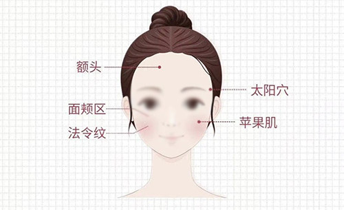 面部注射区 面部注射区