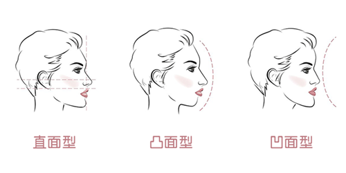牙齿矫正面型问题 牙齿矫正面型问题