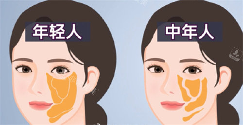 面部脂肪室对比