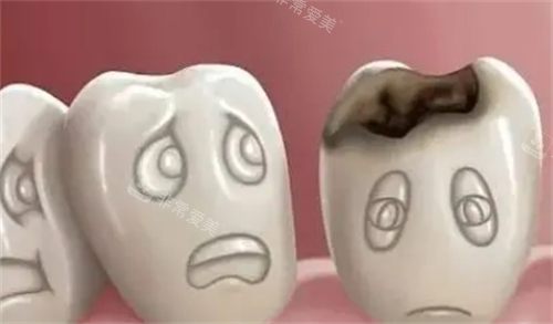 烂牙齿动画展示